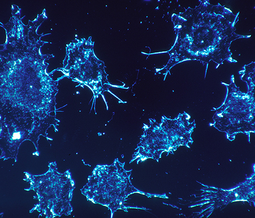 Как возникают раковые клетки?