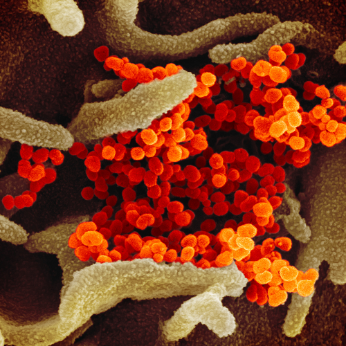 SARS-CoV-2 (обозначен оранжевым) на клеточной культуре