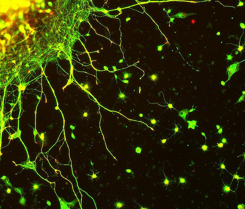 FAQ: Структура нервной клетки