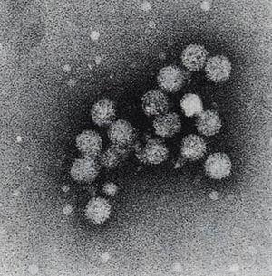 Фото вируса гепатита С, полученное под трансмиссионно-эмиссионным микроскопом